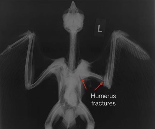 Humerus fxs.001