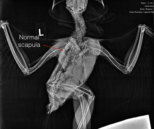 Normal scapula.001