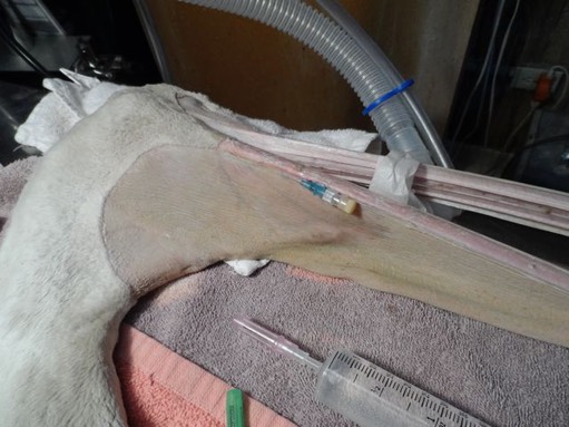 Pelican catheter.jpg